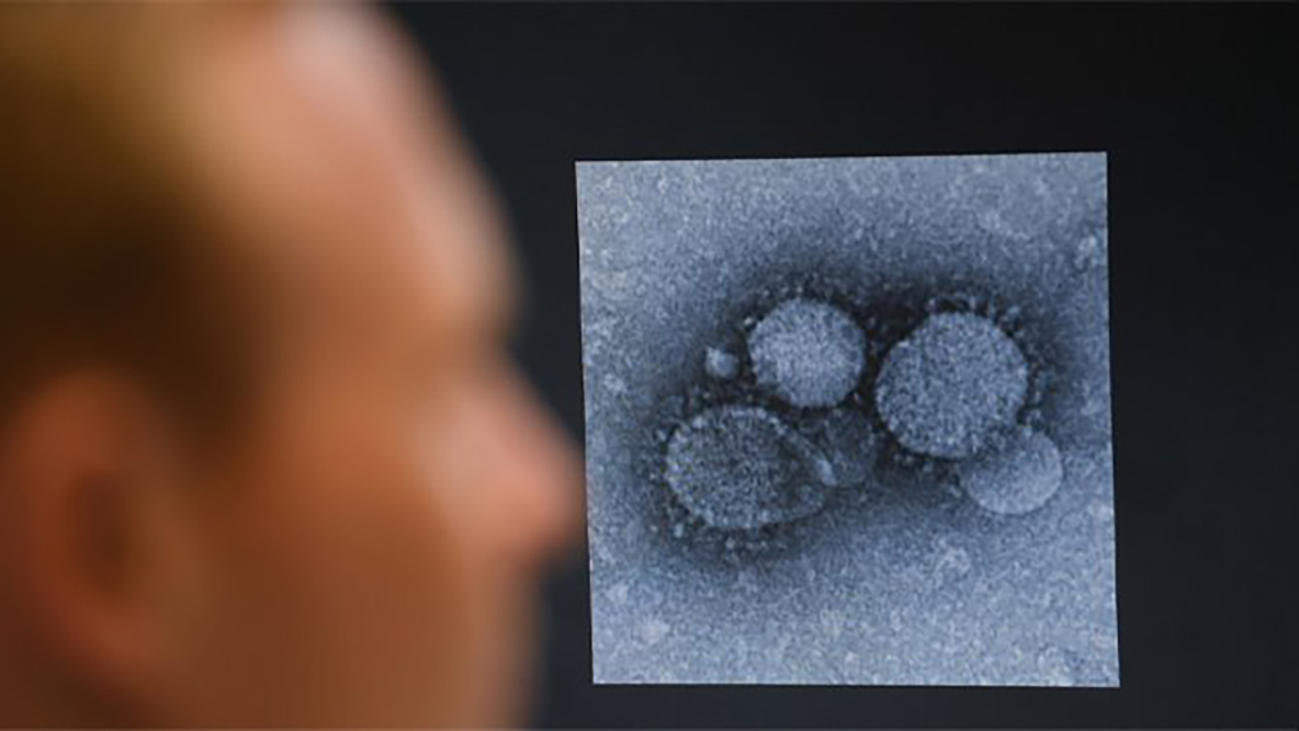 Coronavirus del síndrome respiratorio de Oriente Medio reaparece en Qatar cobrando primer vida