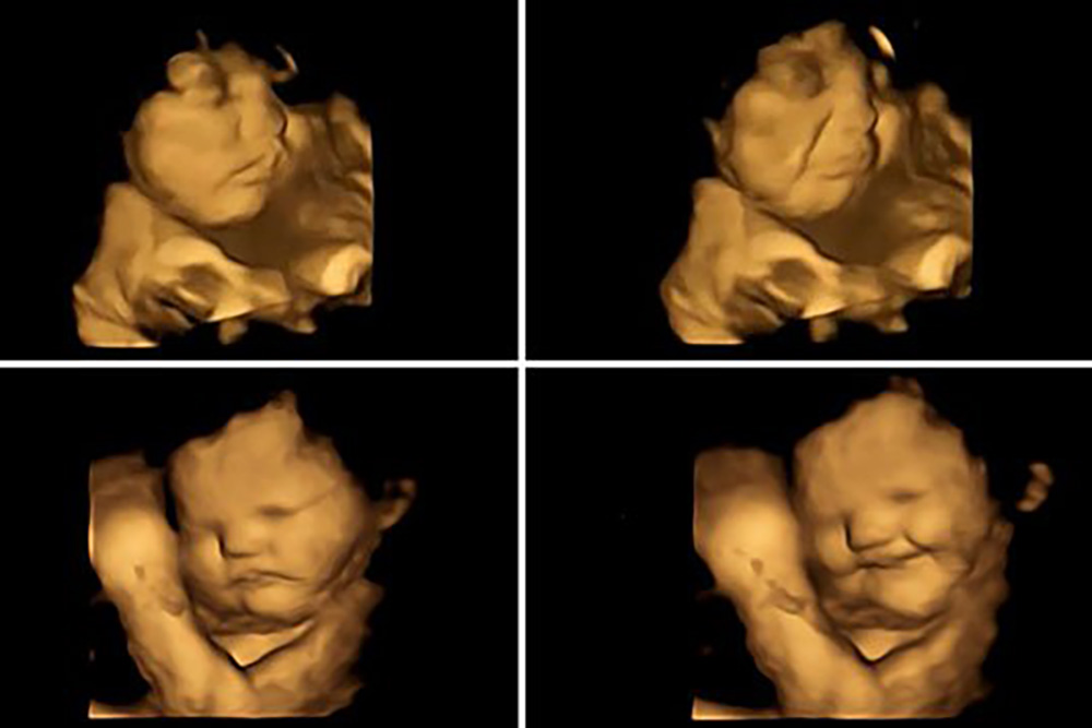 Registran tiernas reacciones de bebés en el útero a lo que comen sus madres