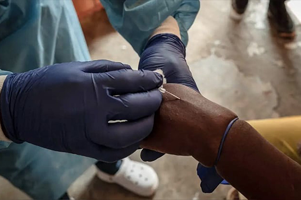 Primeras vacunas contra la viruela del mono llegan al Congo, epicentro de la epidemia